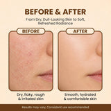 Lindi Skin Face Serum for Sensitive Skin During Chemo, Lavender Scent, 1 Oz